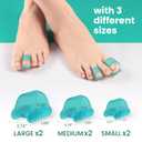 Welnove Hammertoe Corrector - 6 Pack Toe Splints - Soft Gel Toe Straighteners - Realign Bent, Curled, Crooked, Claw, Hammer Toes - Toe Corrector for Men and Women, 3 Different Sizes (Blue)