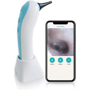 Wireless Otoscope Ear Camera - Remmie Dolphin FDA Registered Wireless Ear Scope Otoscope with Light iPhone, Android and Camera for ENT Throat Nose and Skin, Recommended by Pediatricians for Kids