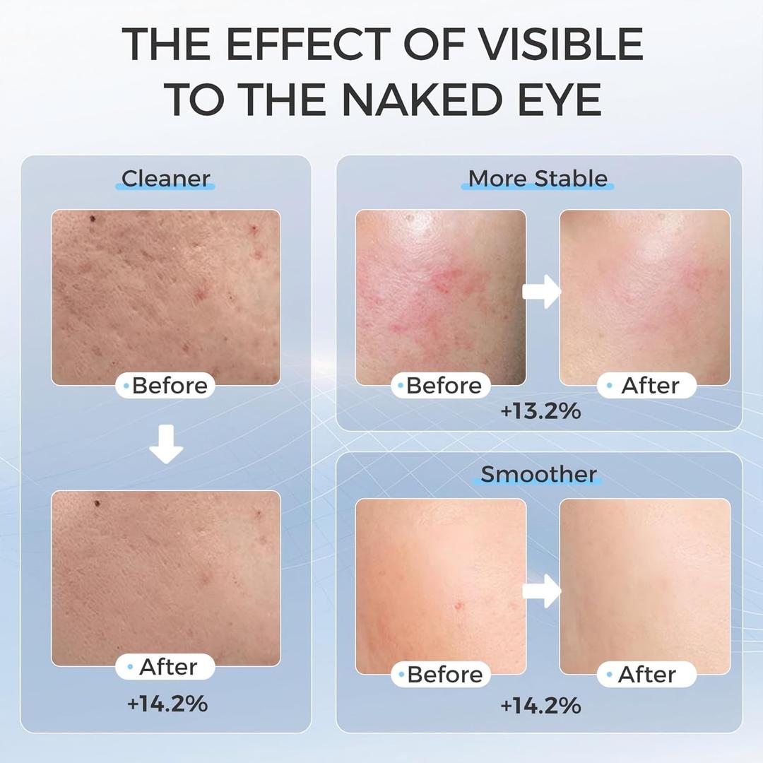 Led Face Mask Light Therapy, Red Light Therapy for Face, 7-1 Colors LED Facial Skin Care Mask