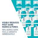 CeraVe Resurfacing Retinol Serum For Post Acne Marks, Formulated With Licorice Root Extract & Niacinamide, Brightening Serum & Pore Minimizer For Face, Post Acne Skin Barrier Repair, Non-Comedogenic