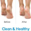 Foot Scrubber Feet Cleaner Washer Brush for Shower Floor Spas Massage, Slipper for Exfoliating Cleaning Foot