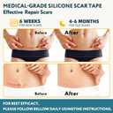 2 x Silicone Scar Tape - 60" x 1.6" Roll - 1.5M, Scar Treatment for Improves Surgical, Keloid, Hypertrophic Scars - Medical Grade Reusable Silicone Scar Sheets (Light)