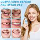 Tooth Repair Kit 2PCS Temporary Tooth Filling, Moldable False Teeth Beads for Teeth Repair