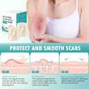 Hydrocolloid Roll for Wound Care,Hydrocolloid Patch Bandages with Self-Adhesive,Grade Hydrocolloid Roll with Self-Adhesive, Ultra Absorbent, Flexible & Waterproof (2in x 12ft) (2PCS)