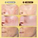 2 x 7-Day Rapid Skin Repair Cream,Intense Cream,All-in-one care cream,Reduce fine lines,Hydrating and Moisturizing, for All Types Skin (2PCS)