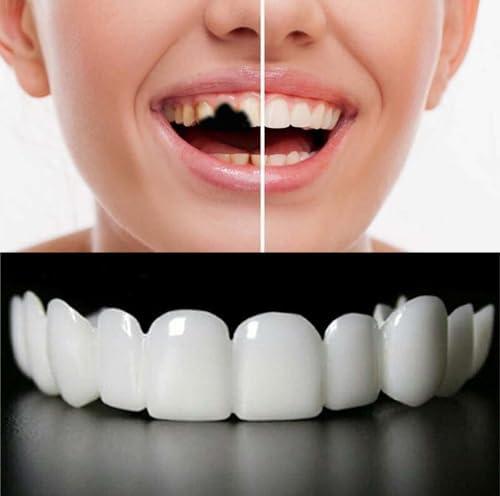 2 Pairs,Regain Beautiful Smile for Men and Women,Temporarily Adjustable(White)