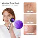 30x Magnifying Dermatoscope with LED, Rechargeable Handheld Skin Analyzer, 4 Lighting Modes & High Clarity Lens for Skin, Scalp & Hair Follicle Observation