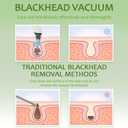 Blackhead Remover Pore Vacuum, Pimple Extractor with 4 Probes and 3 Suction Levels, Electric Facial Cleanser with Extra 4 Pcs Blemish Tool Kit, USB Rechargeable, (White)