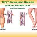 TOFLY 30-40mmHg Medical Graduated Compression Socks for Men & Women, Open Toe Knee High Compression Socks, Firm Support for Circulation Recovery, Shin Splints, Post Thrombotic Syndrome, Begie XXL