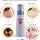 Acne Treatment For Sensitive Skin - 80% of Acne Gone in 4 Weeks. Pimple Cream Stops Face Acne and Teen Acne Without Drying or Irritating Skin. Zit Cream, Face Toner for Pimple Prone Skin.