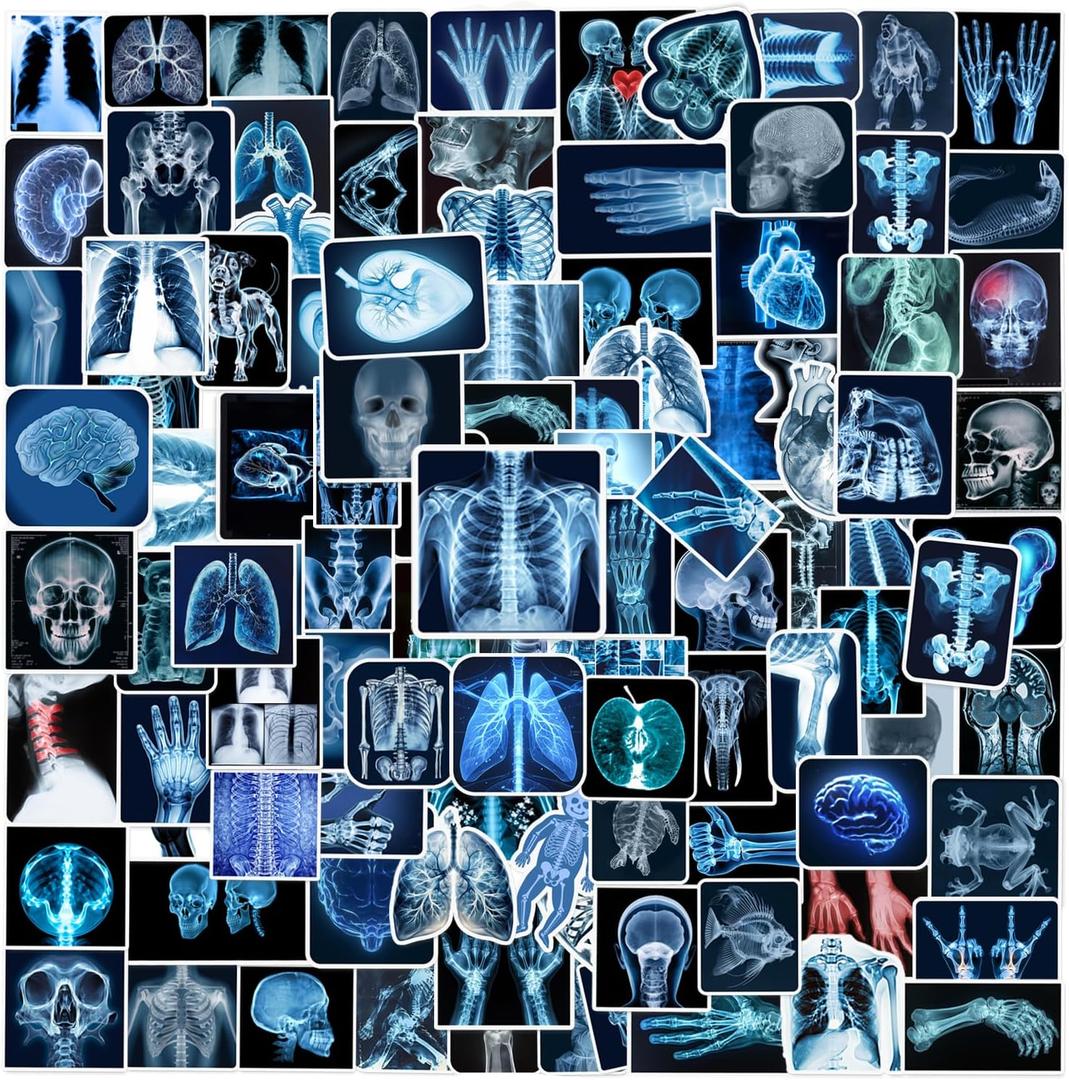 110PCS Radiology X Ray Stickers, Radiology Party Favors Birthday Party Decorations Vinyl Waterproof Stickers for Water Bottle Laptop Luggage Xray Tech