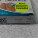 Opti-Nail Fungal Nail Repair Pen, Restores the Healthy Appearance of Nails Discolored or Damaged by Nail Fungus