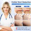 3 x NewX Fast Action Wart Gel Maximum Strength - Wart with Salicylic Acid - Fast-Acting Wart Freeze Off Designed for Warts, Plantar Wart, Genital Wart, Common Wart, Flat Wart, Corn, Callus-G-03