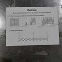 Retractable Pickleball Net - Durable and Lightweight Indoor/Outdoor Portable Pickleball Net with Steady Metal Frame, Free Assembly & Carry Bag for Backyards, Driveways and Garages