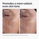 The Ordinary Glycolic Acid 7% Exfoliating Toner, Brightening and Smoothing Daily Toner for More Even-Looking Skin Tone (8.11 Fl Oz (Pack of 1))