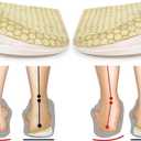 BIGGCOOL Corrective Insoles for Supination & Over-Pronation, Orthotics Medial & Lateral Heel Wedge Inserts for Foot Alignment, Bow Legs, Knee Pain (Beige-3 Layers, S: Women 4-7.5/Men: 6-7)