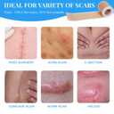 Silicone Scar Sheets, Silicone Scar Tape Roll (60x1.6), Professional Scars Removal Treatment, Scar Silicone Strips, Reusable Silicone Scar Strips Type for Keloid, C-Section, Surgery, Keloid, Acne