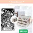 Jewelry Box For women, 3 Layer Large Jewelry Organizer With Acrylic, Multi-Function Storage Box, Accessory Holder With 3 Drawers, For Earrings Necklace Ring Bracelet