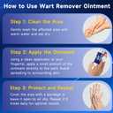 10 x Fast Acting Wart Remover, with Salicylic Acid for Women and Men, Corns, Flat, Common and Plantar Warts 20g