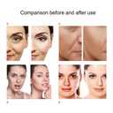 7 Color LED Face Mask LED Light Therapy Equipment for Skin Care at Home Beauty Salon Equipment, White