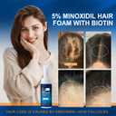 Minoxidil Hair Serum spray for Men and Women, 5% Minoxidil Hair Serumpromotes hair growth, makes hair and beard thicker and fuller (60ml)