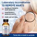 SKAYAH Wart Remover Freeze Off - Heavy-Duty Plantar, Common Warts & Corns Treatment, Visible Results-1120