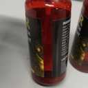 5% Minoxidil for Men & Women, Advanced Formula Hair Regrowth Spray and Topical Solution for Thinning Hair and Beard, Long-Lasting Results