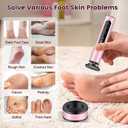 Electric Foot Callus Remover with LED Battery Level & 9-Speed Control Display. Callus Remover for Feet with Wireless Charger, Multi-sandpaper (70 Sheets) & Nano Glass Head for Dead Skin (Pink)