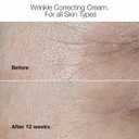 Clinique Smart Clinical Repair Wrinkle Correcting Anti Aging Face Cream With Hyaluronic Acid + Peptides For All Skin Types | Hydrating