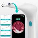 Voraiya Electronic Tonsil Stone Remover Upgraded Version, Built-in Camera and LED Light, 5-Level Suction and 2 Suction Modes Tonsil Stone Vacuum Cleaner, Oral Care Tool, Tonsil Stone Removal Kit