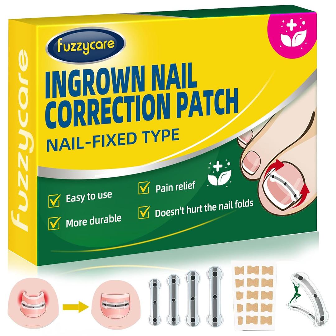 Small Size-Titanium Alloy Ingrown Toenail Treatment & Removal Kit for Quick Relief, Ingrown Toenail Removal Kit Professional Ingrown Toenail Corrector, Ingrown Toenail Tools for Quick Relief, 10 Pcs (0.45/0.51/0.55/0.59 Inch)