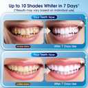 Teeth Whitening Kit with LED Light 3 Whitening Gel Pens + 2 Desensitizing Pens 35% Carbamide Peroxide Whiten Teeth in 7 Days Safe for Sensitive Teeth & Enamel, 0.7 Fl Oz (Mint)