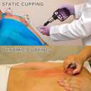 Cupping Kit for Massage Therapy Set with Pump 12 Massage Cups for Cellulite Reduction Muscle Back Pain Relief Physical Therapy