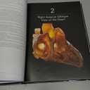 Atlas of Cardiac Anatomy: Anatomical Basis of Cardiac Interventions, Volume 1 Hardcover