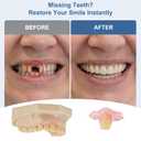 Custom Partial Dentures for Missing Teeth Removable Flipper Tooth, Clip-In Teeth Replacement, Natural Looking Temporary Tooth Solution for Front or Back Teeth (1 Tooth)