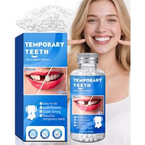XLMCWT Tooth Repair Kit, Moldable False Teeth Beads for Teeth Repair, Suitable for Missing, Cracked DIY Denture Kit, 1PCS