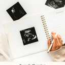 Lamare Pregnancy Journal for First-Time Moms Pregnancy Planner, Sonogram Photo Album & Pregnancy Scrapbook for Expecting Moms First Time Mom Gift, Pregnancy Must-Have