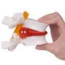 breesky Human Anatomical Lumbar Disc Herniation Model:1.5 Times Life Size Lumbar Disc Teaching Model Tool-for Medical &Teaching & Learning and Scientific Presentations
