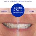 Supersmile Dissolving Superstrips - Professional Teeth Whitening Strips - Enamel Safe Teeth Whitener For Sensitive Teeth