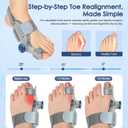 Bunion Corrector for Women Men Big Toe,Adjustable Knob Bunion Corrector for Bunion Relief,Bunion Fix with Bunion Silicone Pad,Suitable for Left and Right Feet(2PCS) (Gray)