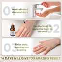 2 x "STAY STOKED" Wart Remover, Maximum Strength Wart Remover Freeze Off - Heavy-Duty Treatment for Stubborn Plantar Warts, Corns & Common Warts, Fast Results in 1-2 Weeks-H5516