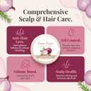 2 Pack Onion Biotin & Rosemary Shampoo Bar for Hair Growth & Anti-Hair Loss, 3-in-1 Hydrating Hair Soap for Thinning Hair, Moisturizing Cleanser Hair Care