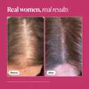 Viviscal Hair Growth Supplements For Women For Thicker, Fuller Hair, Nourishes Thinning & Loss, With Proprietary Collagen Complex, 180 Tablets, 3 Month Supply