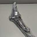 2 Pcs 24" and 16" Large Christmas Tree Stand for Artificial Foldable Metal Xmas Tree Stand Replacement Christmas Base for 6.5 to 8 ft, Fits Poles up to 1.3" and 0.7"(Dark Green)