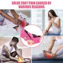 Plantar Fasciitis Night Splint Relief Brace,Plantar Fasciitis Relief Straps,Support Relief Foot Drop Achilles Tendonitis(Pink-2PC)