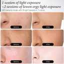 SDKWDH Red Light Mask for Face, 7-1 Colors Facial Care Mask, 850nm Infrared & Red Light Masks, Ergonomic Design for Home & Travel, Pink