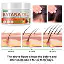 Frovetani Batana Oil, 4.2 Fl Oz - 100% Organic Raw from Honduras for Hair Growth, Promotes Thickness, Healthier & Strengthening, Prevents Hair Loss, Hair Mask