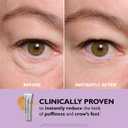 Peter Thomas Roth | Instant FIRMx Eye Temporary Eye Tightener Easy-Wear Formula | For Firming Under-Eye Bags & Wrinkles