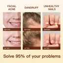 Peppermint Essential Oil Blend, Mint Oil Enhances Hair Thickness, for Hair Growth, Used for Sleep, Acne Treatment, Scalp Care, Essential Oils for Diffusers for Home - 30ml