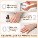 4pcs  "STAY STOKED" Wart Remover, 15ml Fast-Acting Wart Freeze Off with Natural Herbal Extracts - Gentle Yet Powerful for Common Warts, Plantar Warts on Hands/Feet-0123